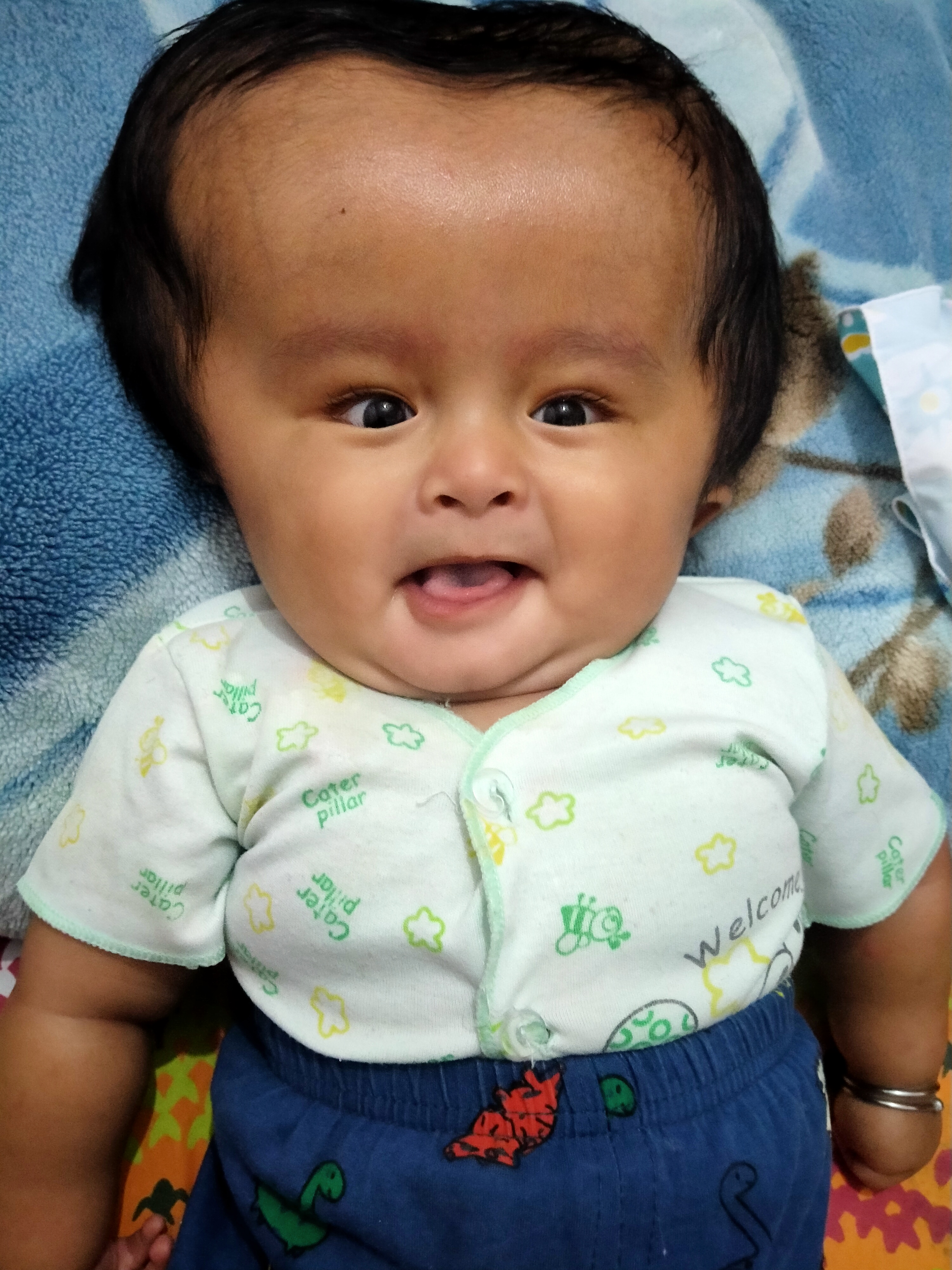 keenanpejuanghidrosefalusdalamkandungan